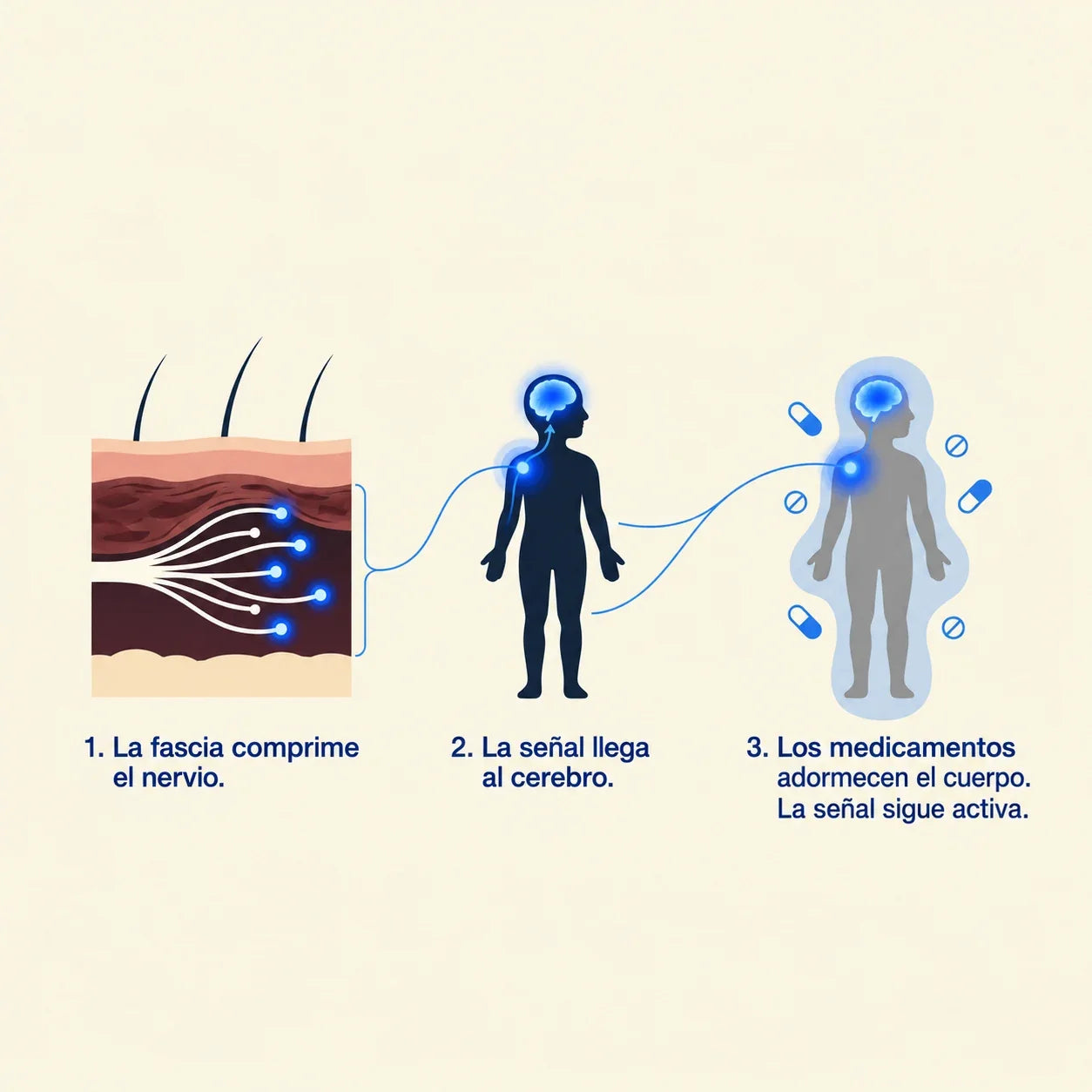 Esquema ilustrativo de compresión y señal nerviosa